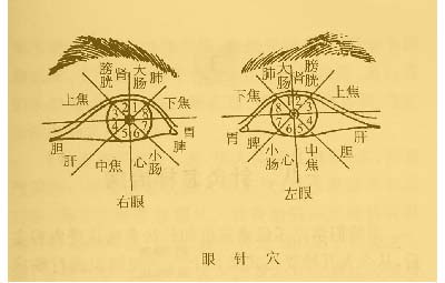 耳针、头针及眼针法禁忌