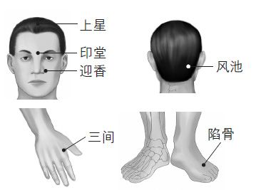 老打嗝怎么办？试试中医针灸